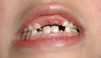 �����������Ƃ���